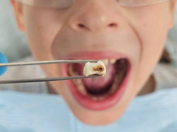 Best Pediatric Emergency Dentist in South Wenatchee, WA