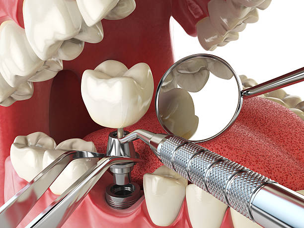 Best Walk-In Emergency Dentist in South Wenatchee, WA